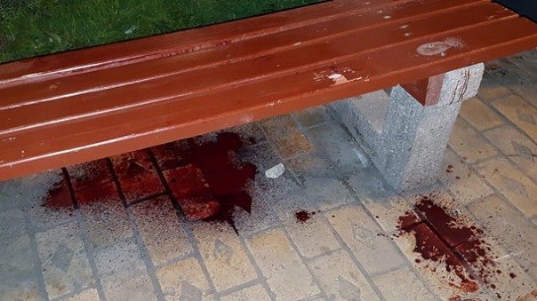 В центре Киева утилизировали хероя АТЫ начальника разведки 54-й ОМБР