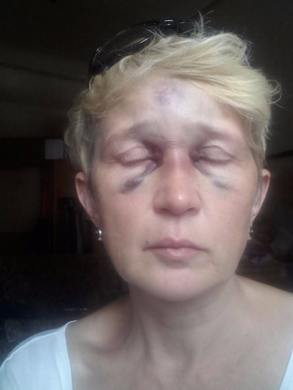 Цивилизованная Цэевропа: в Одессе избита известная журналистка