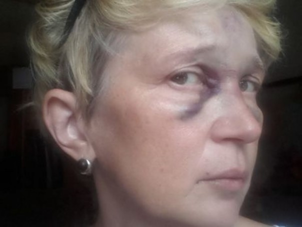 Цивилизованная Цэевропа: в Одессе избита известная журналистка