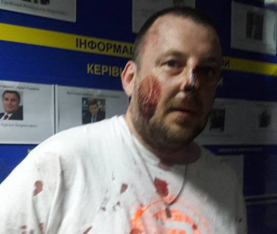 Киевская полиция задержала боевиков «АТО», устроивших провокации 18+