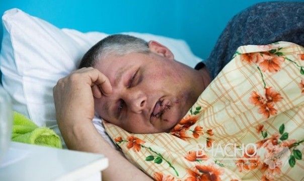 За выкрик «Слава Украине» «патриоту» разбили голову в оккупированной части Донбасса