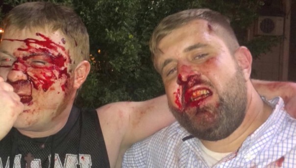 Захарченко: Ударивший журналиста негодяй зря прикрывался именами "Оплота" и ДНР.  Журналисты установили личность "ВДВшника"