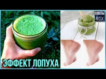 Гладкие пятки в домашних условиях с помощью лопуха. Потрясающий рецеп. Пятки как у младенца
