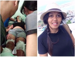 Ревнивый муж с мачете отрубил жене ступню на глазах у детей