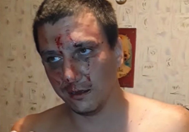 В Чернигове неонацисты избили и заставили извиняться пророссийски настроенного местного жителя