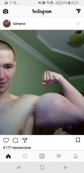 Синтол пришёл в Россию и уже начал калечить