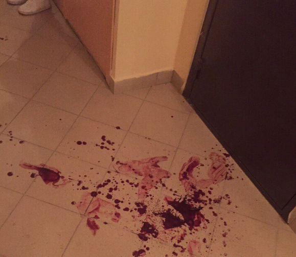 Голые новосибирцы устроили бой на ножах и залили подъезд кровью [Видео 18+]