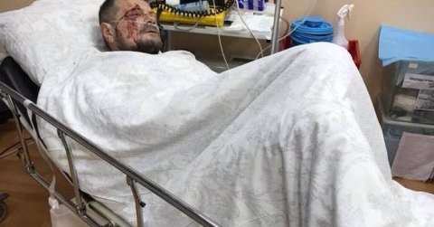 В Киеве под редакцией телеканала "Эспрессо" прогремел взрыв. Обезжиренный Мосийчук получил ранение (Видео)