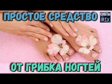 Грибок ногтей на ногах. Лечение в домашних условиях. Средство всего из 3-х компонентов. Планета здоровья
