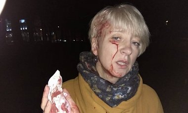 В Полтаве бандиты в масках избили судью трубой по голове