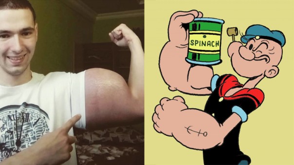 Daily Mail: российскому «морячку Попаю» грозит инвалидность