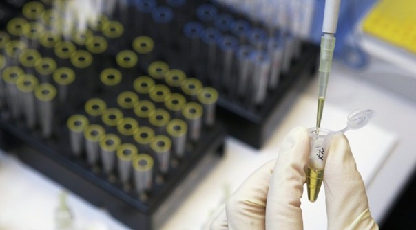 Российский лыжник о допинг-пробах: это камни из почек выходили и все поцарапали