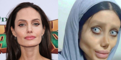 Что-то пошло не так: Девушка хотела стать Анджелиной Джоли, а превратилась в "Труп невесты"