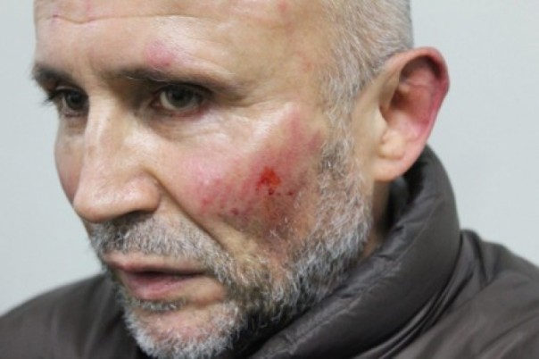 Конкурента Порошенко настолько избили, что его отказались принимать в СИЗО