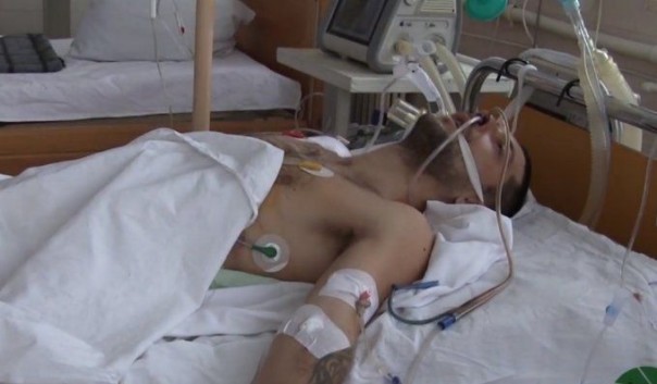 Укрофашисты показали тяжелораненого пленного бойца ВС ДНР