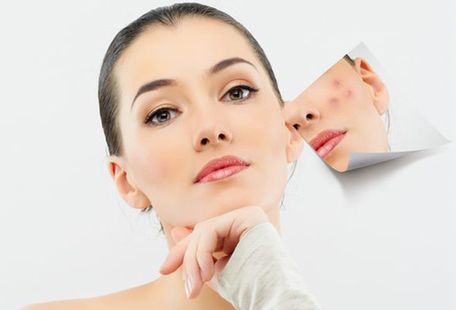 Лазерная шлифовка лица: все, что нужно знать