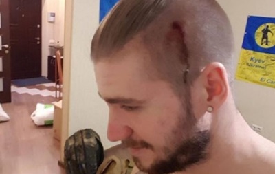 В Киеве настучали по голове "плюющемуся хрюмбергу"