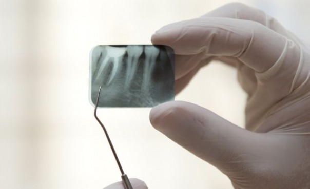 Особенности проведения прицельного снимка зубов