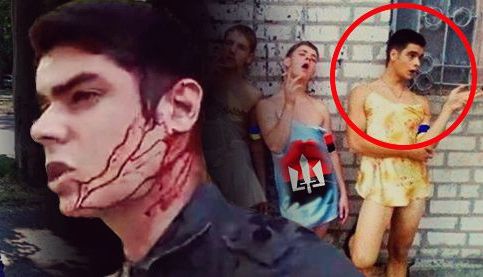 В Одессе пробили голову и ранили в бедро лидера местного “Автомайдана”