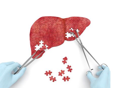 Софовир – настоящий прорыв в сфере лечения гепатита С