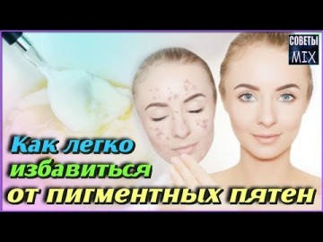 Как избавиться от пигментных пятен на лице в домашних условиях. Простые и доступные рецепты красоты