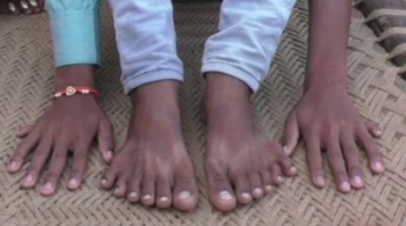 Родственники принесут в жертву мальчика с 24 пальцами ради обещанного богатства