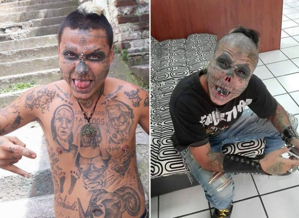 Зовите санитаров: 22-летний парень отрезал себе нос и уши, чтобы стать похожим на скелет