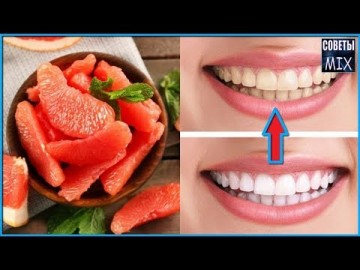 Вот какие неожиданные продукты и напитки портят ваши зубы. Избегайте их. Полезные советы для здоровья