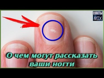 Взгляните на руки: Секреты, которые могут рассказать ногти. Как определить болезнь по состоянию ногтей