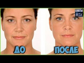 Как убрать морщины на лице за одну неделю. Легко и быстро в домашних условиях. Рецепт красоты