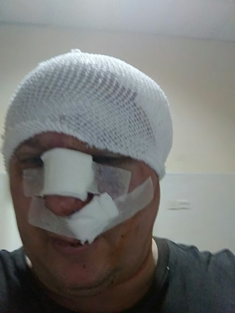 В Киеве проломили голову догхантеру. 18+