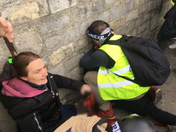 В Париже участнику акции "желтых жилетов" гранатой оторвало кисть руки