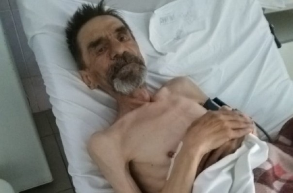 В екатеринбургской больнице с онкобольного взяли 50 тысяч за бесплатный протез и не установили его