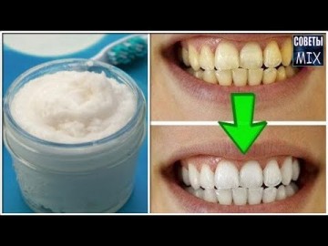 Как отбелить желтые зубы за 2 минуты в домашних условиях. Секрет белоснежной улыбки. Рецепт здоровья