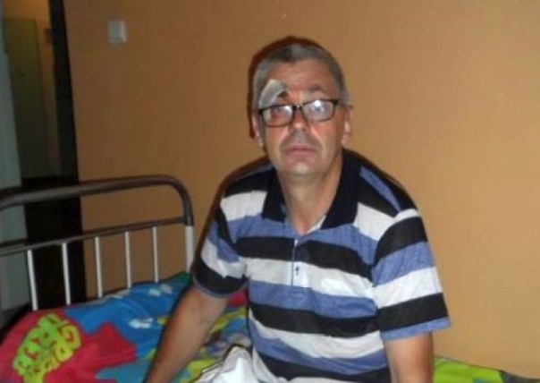 Избитый в Черкассах журналист впал в кому