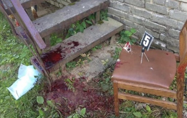 На Львовщине стоматологу перерезали вены в кабинете