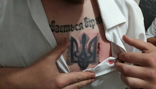 Ножом в грудь "за правду": один кандидат в депутаты обвинил другого в покушении