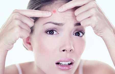 Прыщи на лице: причины, избавление