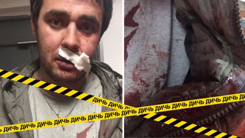 Шестеро с битой напали на депутата возле "разливайки" в Челябинске