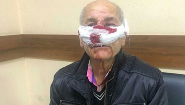 Взял за горло и начал душить: в Петербурге врач скорой помощи избил пенсионера