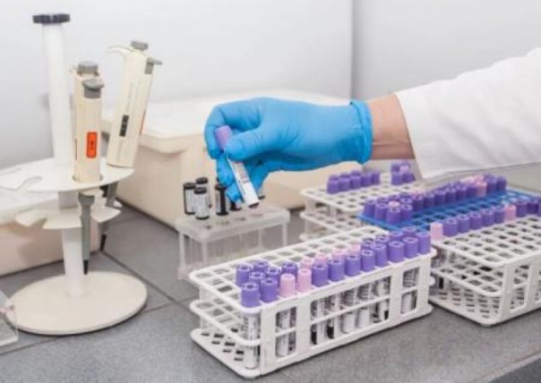 В мире число заболевших коронавирусом превысило 1,2 миллиона человек