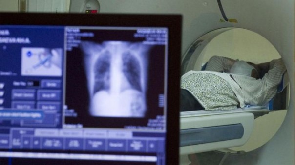 У бессимптомно переболевших COVID-19 обнаружили поражения легких