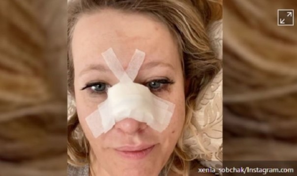 Собчак сломала нос и получила сотрясение