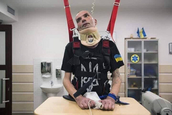 Опубликованы шокирующие фото украинских солдат, вернувшихся с Донбасса. 18+