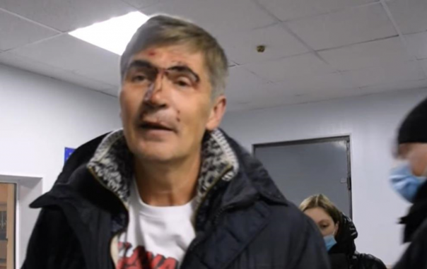 В Николаеве экс-нардеп от Блока Петра Порошенко сел пьяным за руль, пытался бежать и устроил драку с полицией