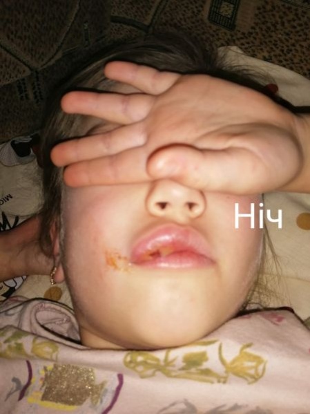 Стоматолог из Ровно душила и избивала маленьких пациентов — полиция открыла дело