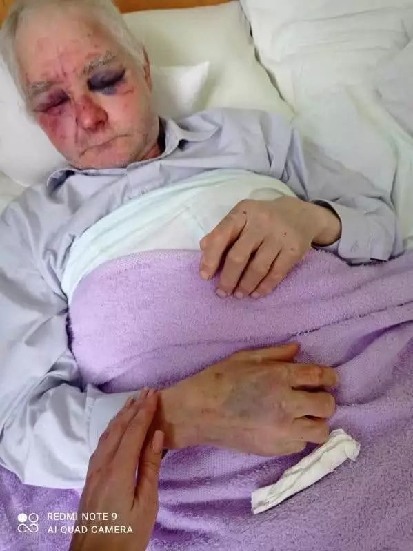 На Буковине сторонники ПЦУ жестоко избили 63-летнего прихожанина УПЦ