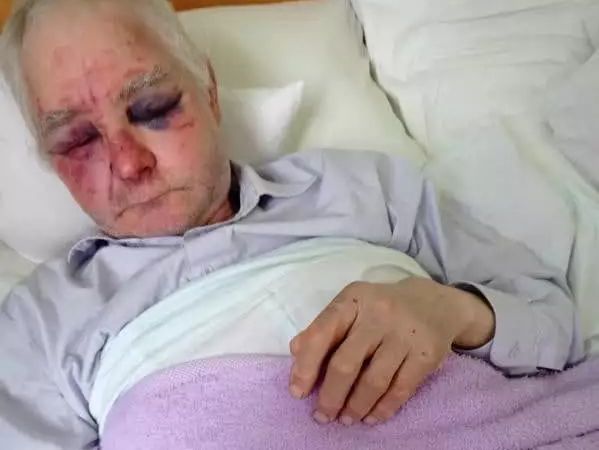 На Буковине сторонники ПЦУ жестоко избили 63-летнего прихожанина УПЦ