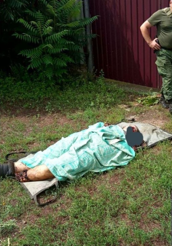 Тихая война: мины и неразорвавшиеся боеприпасы убивают и калечат жителей Донбасса