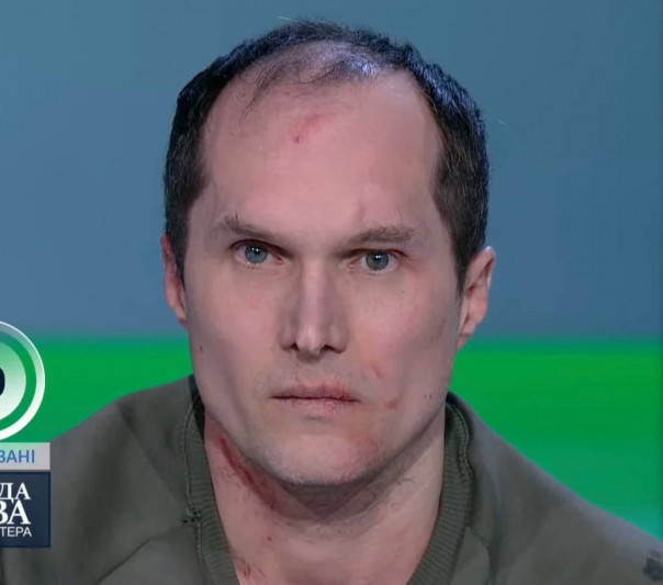 Один из главных пропагандистов Киева Бутусов оформил отсрочку от мобилизации и в тот же день призвал украинцев идти воевать